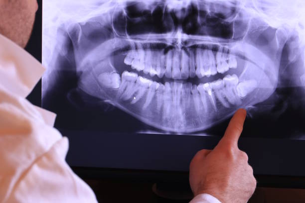 Best 24-Hour Emergency Dentist in Mccullom Lake, IL
