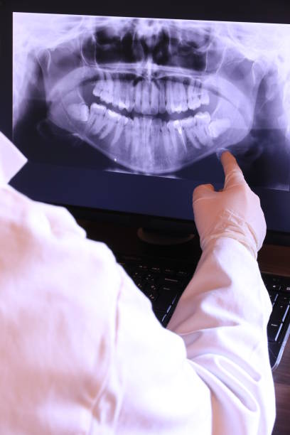 Best Emergency Dentist for Lost Fillings or Crowns in Mccullom Lake, IL