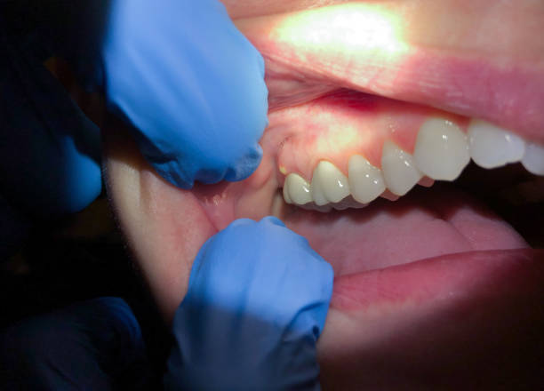 Best Holiday Emergency Dentist in Mccullom Lake, IL