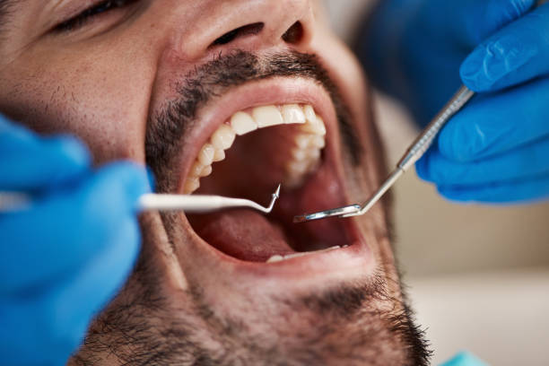 Best Pediatric Emergency Dentist in Mccullom Lake, IL